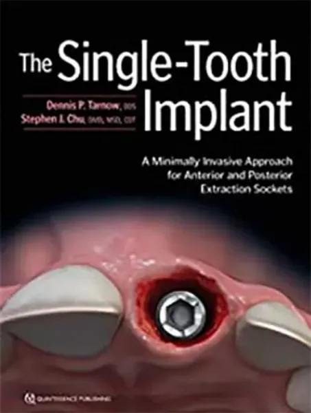 Imagem de The Single-Tooth Implant A Minimally Invasive Approach for Anterior and Posterior Extraction Sockets