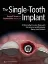 Picture of Book The Single-Tooth Implant A Minimally Invasive Approach for Anterior and Posterior Extraction Sockets