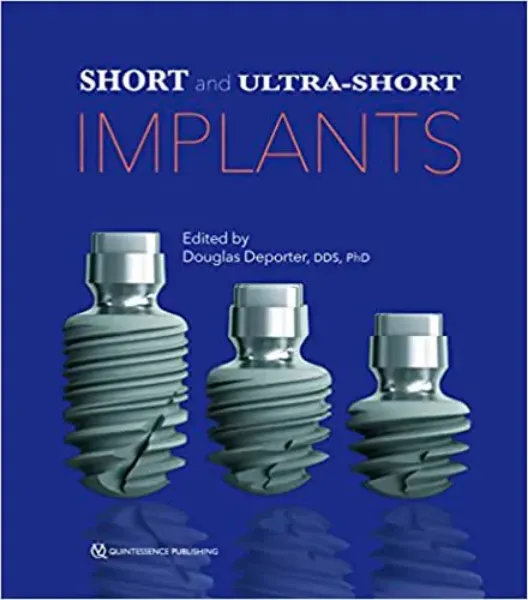 Imagem de Short and Ultra-Short Implants