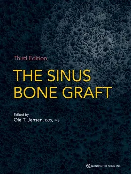 Imagem de The Sinus Bone Graft