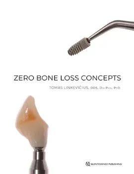 Picture of Book Zero Bone Loss Concepts