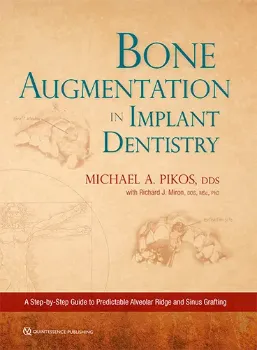 Picture of Book Bone Augmentation in Implant Dentistry: A Step-by-Step Guide to Predictable Alveolar Ridge and Sinus Grafting