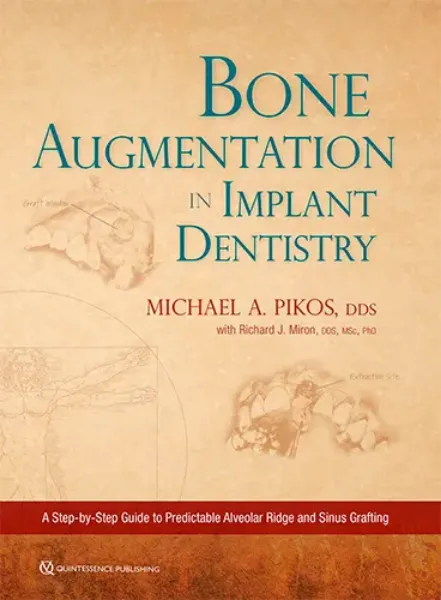 Imagem de Bone Augmentation in Implant Dentistry: A Step-by-Step Guide to Predictable Alveolar Ridge and Sinus Grafting