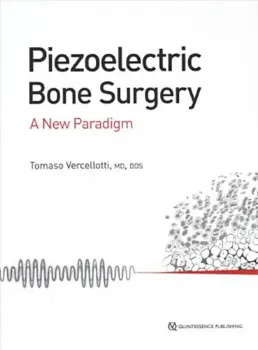 Imagem de Piezoelectric Bone Surgery A New Paradigme