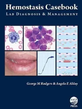 Imagem de Hemostasis Casebook: Laboratory Diagnosis & Management