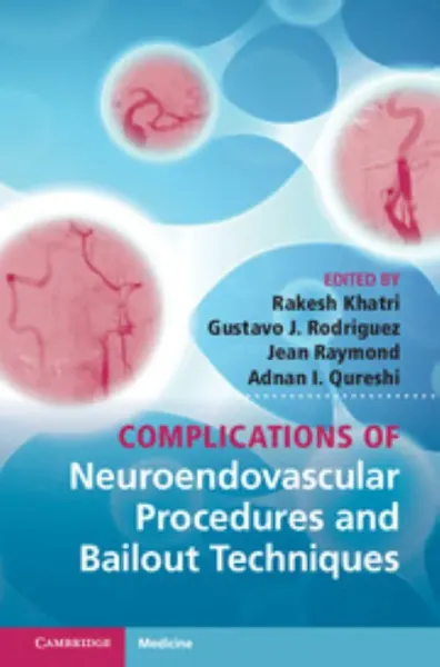 Imagem de Complications of Neuroendovascular Procedures and Bailout Techniques