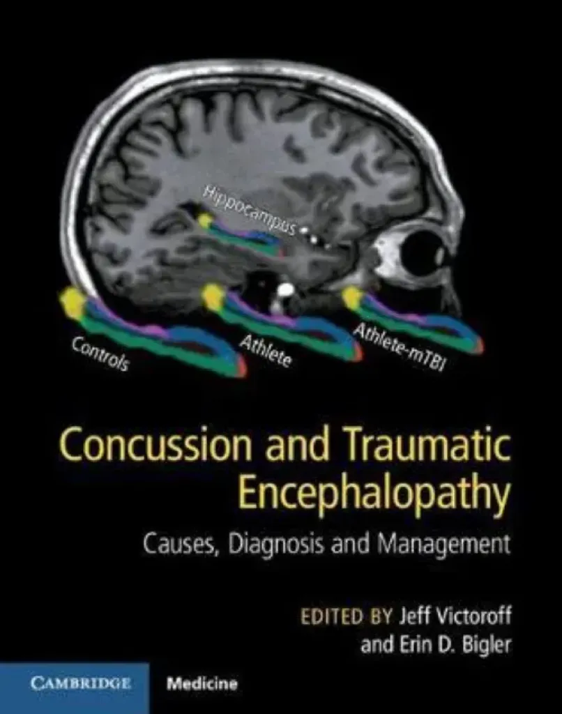 Imagem de Concussion and Traumatic Encephalopathy: Causes, Diagnosis and Management