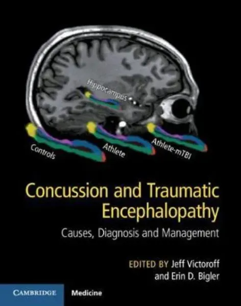 Imagem de Concussion and Traumatic Encephalopathy: Causes, Diagnosis and Management