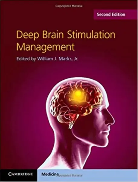 Imagem de Deep Brain Stimulation Management