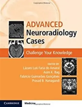 Picture of Book Advanced Neuroradiology Cases: Challenge Your Knowledge