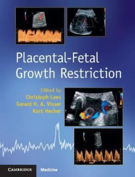 Imagem de Placental-Fetal Growth Restriction