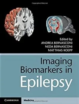 Picture of Book Imaging Biomarkers in Epilepsy