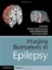Imagem de Imaging Biomarkers in Epilepsy