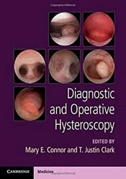 Imagem de Diagnostic and Operative Hysteroscopy