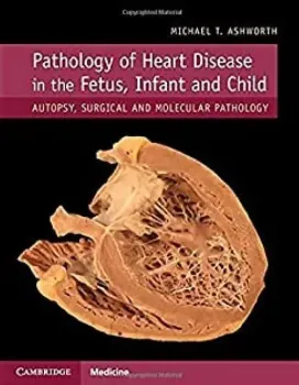 Imagem de Pathology of Heart Disease in the Fetus, Infant and Child: Autopsy, Surgical and Molecular Pathology