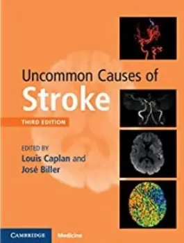 Picture of Book Uncommon Causes of Stroke