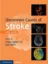 Imagem de Uncommon Causes of Stroke