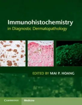 Imagem de Immunohistochemistry in Diagnostic Dermatopathology