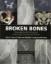 Imagem de Broken Bones: The Radiologic Atlas of Fractures and Dislocations