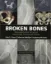 Picture of Book Broken Bones: The Radiologic Atlas of Fractures and Dislocations
