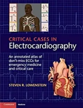 Imagem de Critical Cases in Electrocardiography: An Annotated Atlas of Don't-Miss ECGs for Emergency Medicine and Critical Care