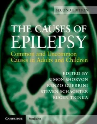 Imagem de The Causes of Epilepsy: Common and Uncommon Causes in Adults and Children