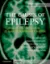 Imagem de The Causes of Epilepsy: Common and Uncommon Causes in Adults and Children