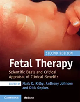Imagem de Fetal Therapy: Scientific Basis and Critical Appraisal of Clinical Benefits