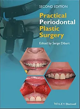 Imagem de Practical Periodontal Plastic Surgery