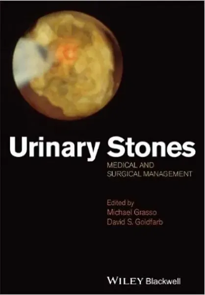 Imagem de Urinary Stones: Medical and Surgical Management