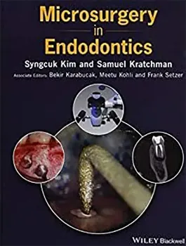 Imagem de Microsurgery in Endodontics