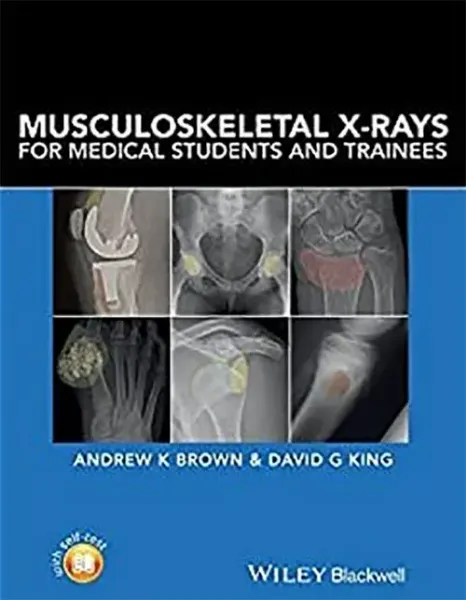 Imagem de Musculoskeletal X-Rays for Medical Students and Trainees