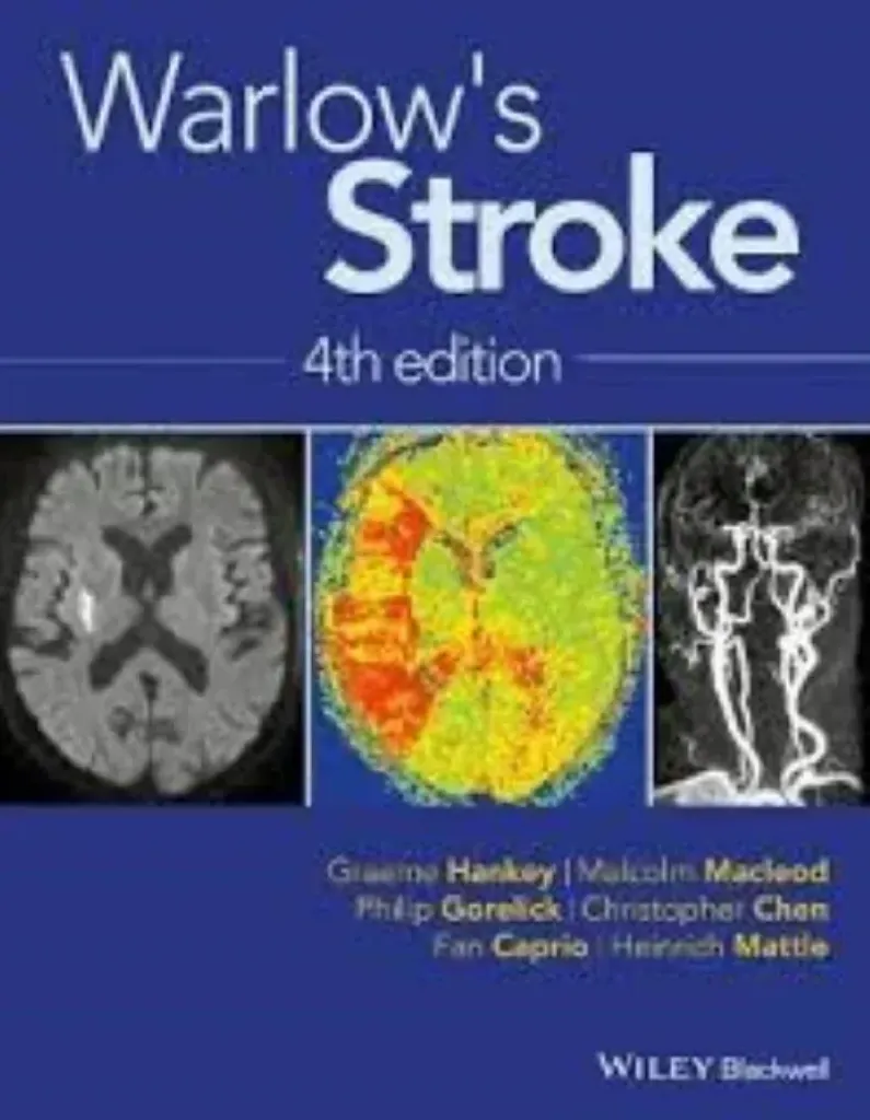 Imagem de Warlow's Stroke: Practical Management