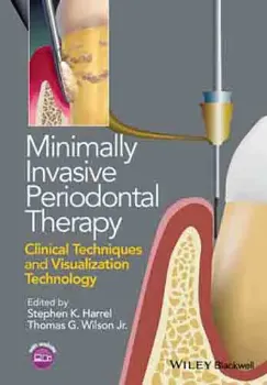 Imagem de Minimally Invasive Periodontal Therapy: Clinical Techniques and Visualization Technology