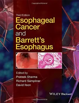 Imagem de Esophageal Cancer and Barrett's Esophagus