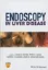 Imagem de Endoscopy in Liver Disease
