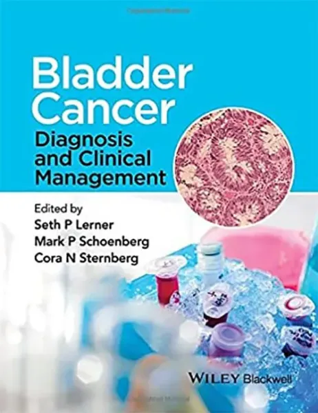 Imagem de Bladder Cancer: Diagnosis and Clinical Management