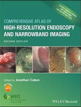 Imagem de Comprehensive Atlas of High-Resolution Endoscopy and Narrowband Imaging