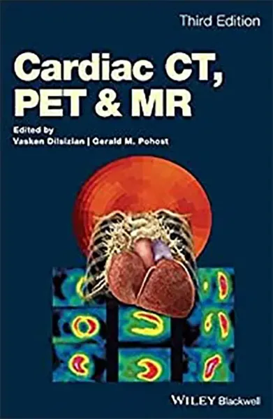Imagem de Cardiac CT, PET and MR