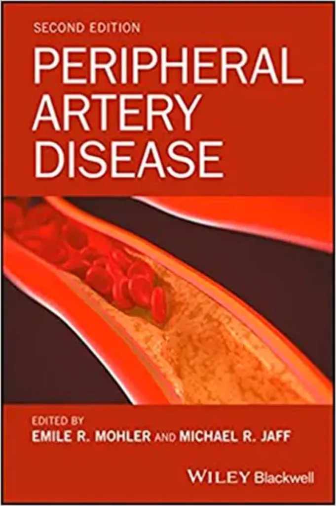 Imagem de Peripheral Artery Disease