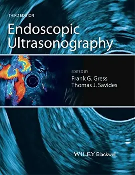 Imagem de Endoscopic Ultrasonography