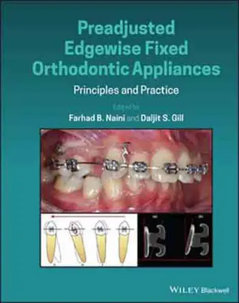Imagem de Preadjusted Edgewise Fixed Orthodontic Appliances: Principles and Practice