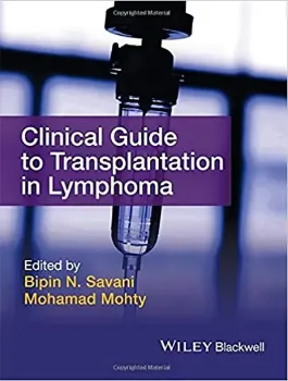 Imagem de Clinical Guide to Transplantation in Lymphoma