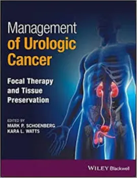 Imagem de Management of Urologic Cancer: Focal Therapy and Tissue Preservation