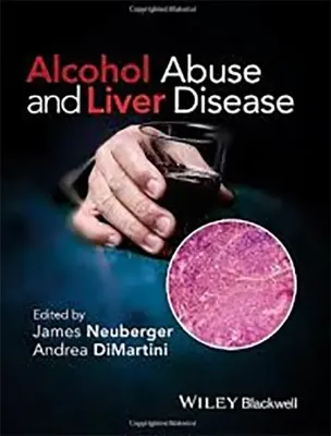 Picture of Book Alcohol Abuse and Liver Disease