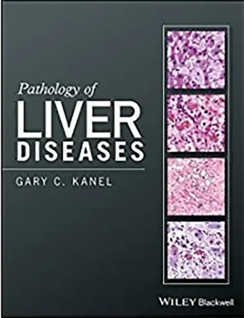 Imagem de Pathology of Liver Diseases