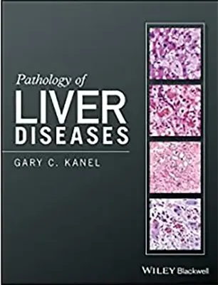 Imagem de Pathology of Liver Diseases