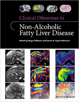 Picture of Book Clinical Dilemmas in Non-Alcoholic Fatty Liver Disease