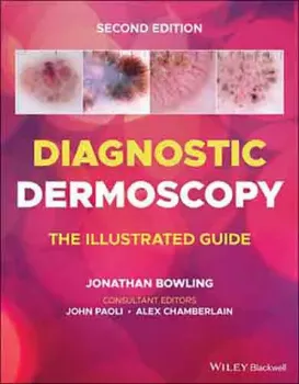 Imagem de Diagnostic Dermoscopy: The Illustrated Guide