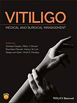 Picture of Book Vitiligo: Medical and Surgical Management